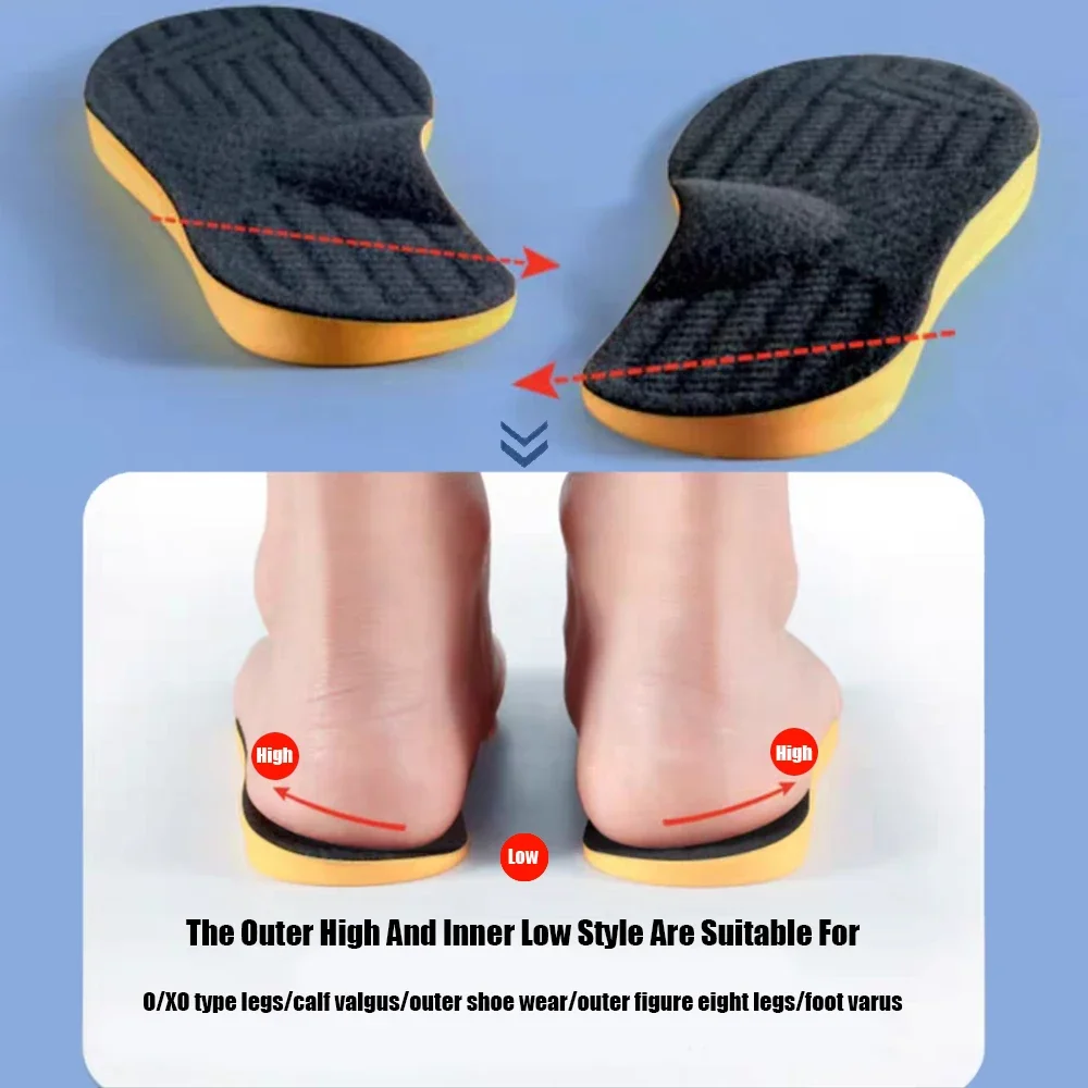 평발용 아치 서포트 깔창 1쌍 O/X 다리 교정용 정형 - Men'S Shoes For Plantar Fasciitis 리뷰 및 가격